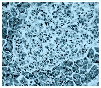 Figura 3. Islotes de Langerhans