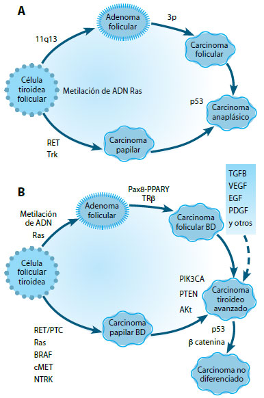 Figura 2. A: Defectos moleculares de las neoplasias tiroi- deas, desarrollo y progresión (modificada de referencia