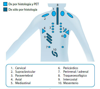 Figura 2. TAP en humanos, distribución del TAP revelado por TEP y por histología
