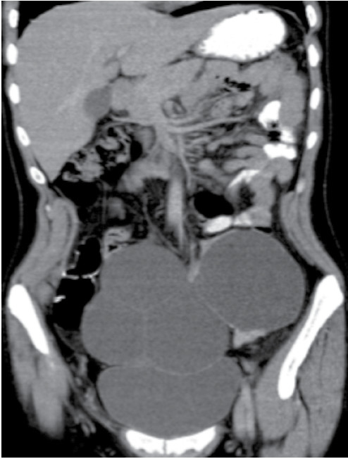 Figura 4. TAC de abdomen