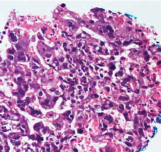 Figura 6. Hematoxilina eosina 40x