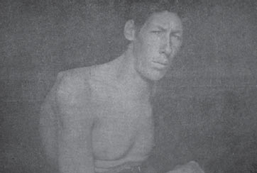 Figura 4. Paciente con acromegalia presentado por el Dr.
